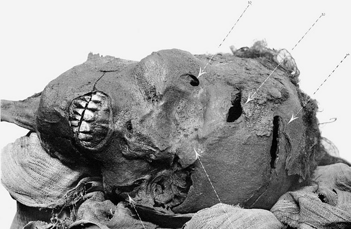 "Mummified head of Seqenenre Tao, bearing axe wounds. The common theory is that he died in a battle against the Hyksos"