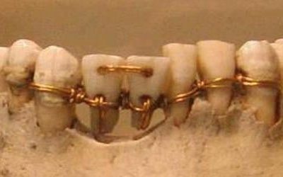 Dentistry in Ancient Egypt