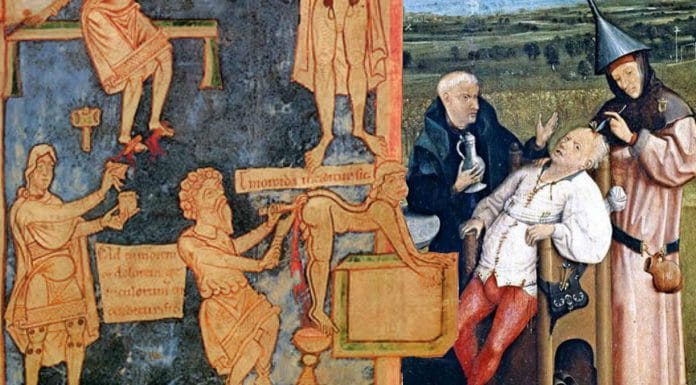 The 5 craziest methods of medicine in ancient times